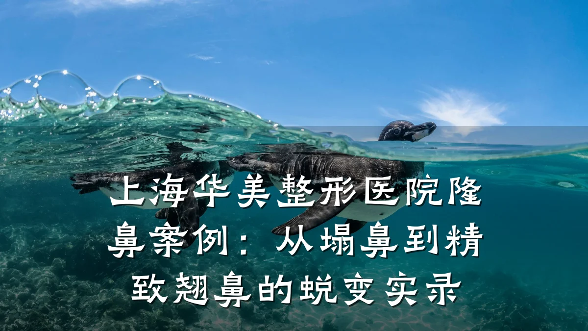 上海华美整形医院隆鼻案例：从塌鼻到精致翘鼻的蜕变实录