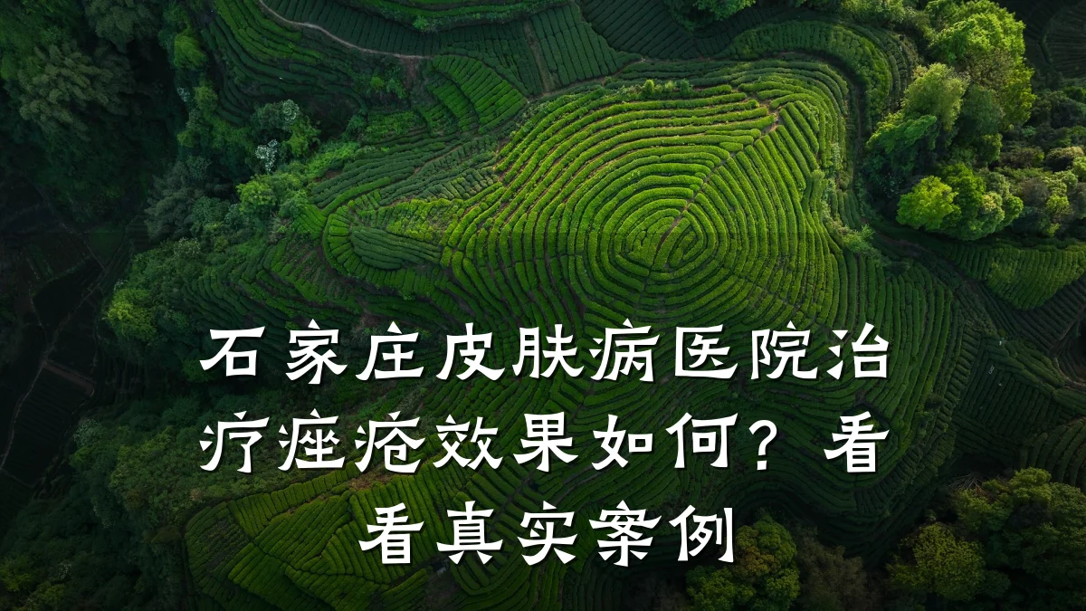 石家庄皮肤病医院治疗痤疮效果如何？看看真实案例