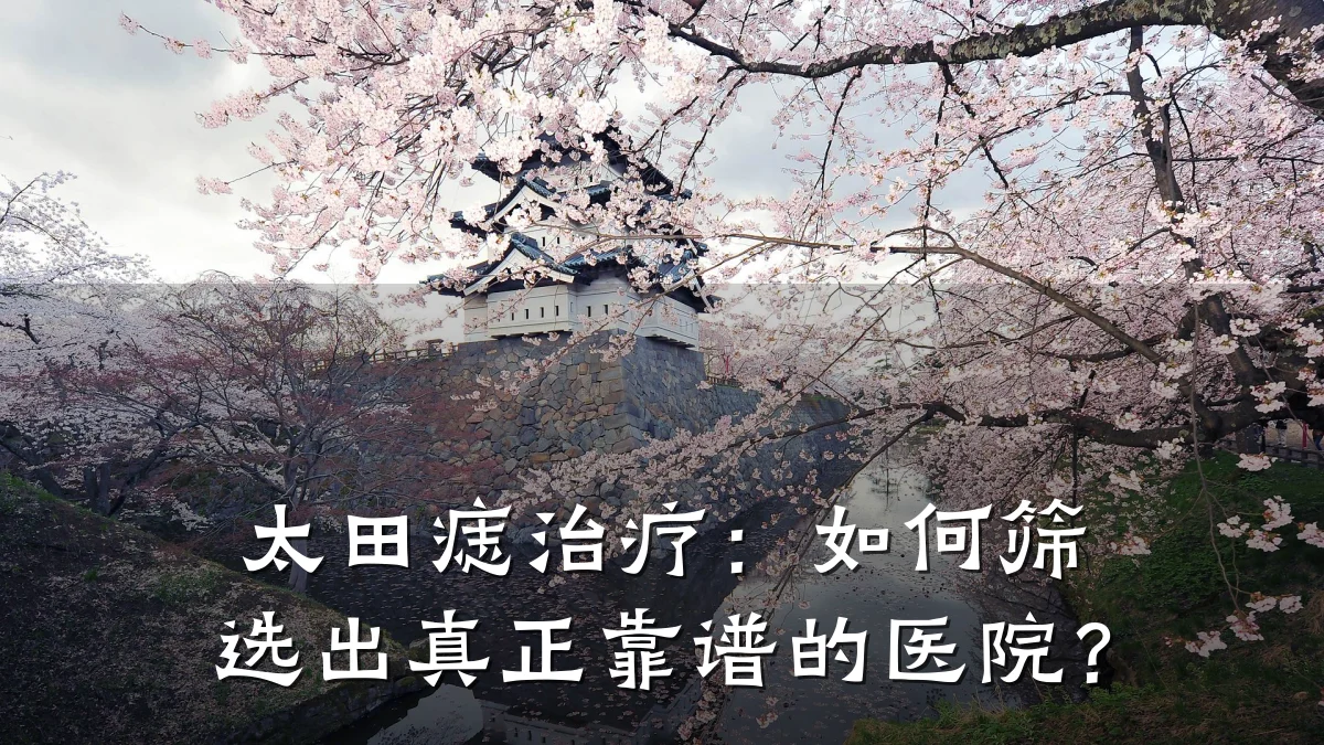 太田痣治疗:如何筛选出真正靠谱的医院?