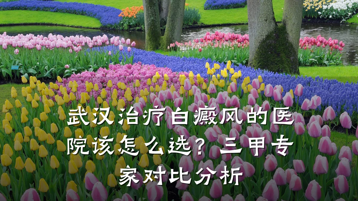武汉治疗白癜风的医院该怎么选？三甲专家对比分析