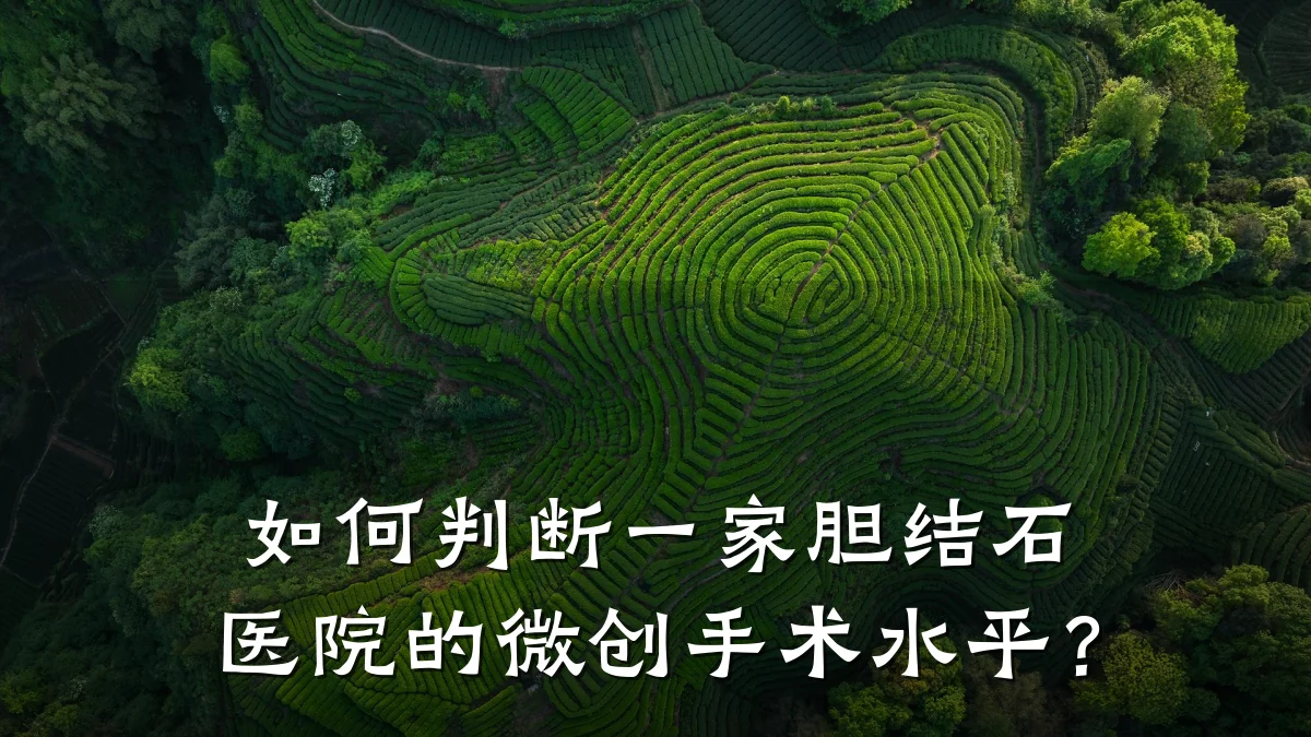 如何判断一家胆结石医院的微创手术水平?