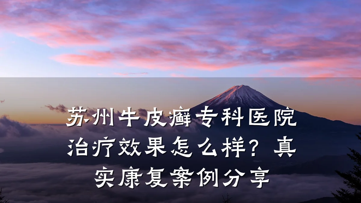 苏州牛皮癣专科医院治疗效果怎么样?真实康复案例分享