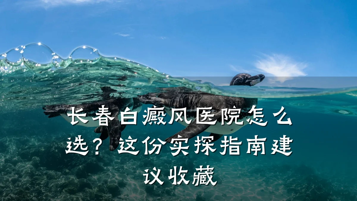 长春白癜风医院怎么选?这份实探指南建议收藏