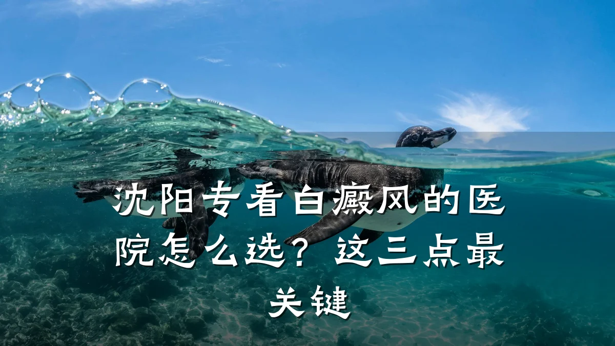沈阳专看白癜风的医院怎么选?这三点最关键